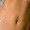 eska group batam eska wellness spa massage & salon reshaping treatment-1-stretch-mark-lightening