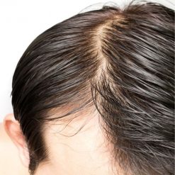 eska group batam eska wellness spa massage & salon 4-oily-scalp